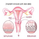 자궁경부암의 식이요법 탐구 - 해리슨내과학, 국립암센터 이미지