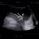 모아산부인과병원 이미지