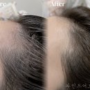 파인드헤어 이미지