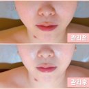 세븐일레븐 부천상동본점 | [부천 더헤르츠스킨 상동본점] 상동에스테틱 추천 이유ㅣ전후 차이 확실했던 피부관리