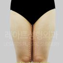 레아트성형외과의원 이미지