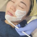 동탄피부관리 여드름케어 잘하는 채움피부연구소