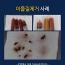 고은리프트의원 이미지