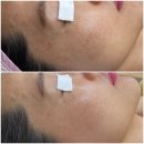 세이에너지 | 광주 피부관리 수완지구 세이뷰티 크레이지015 리프팅 관리 후기