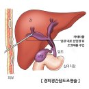 많이 본 검사/시술/수술 정보 이미지