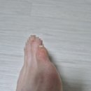 신신목욕탕 | 신신 티눈밴드 사용 후기(티눈, 사마귀 제거) 총 6일만에 깨끗이 떨어졌어요!