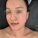 공주뷰티샵 | 대구 동성로 뷰티샵 쌩얼공주에서 핫한 SFT 윤곽관리 받은 후기