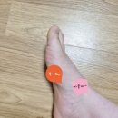 (주)글로메딕 | 피겨화 통증 극복하기 2 ㅣ인솔 잘라서 넣어보기, 앞꿈치 하이힐 패드 고정형 아치 인솔 온아이스 후기는??