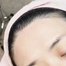 혜성빌딩 | 좁은이마 고민, 청담 무무왁싱 헤어라인 왁싱 후기