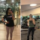 선덕한의원 | 뼈팔 지방흡입 대신 팔뚝 지방분해주사 1회 시술 후기