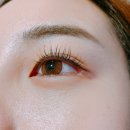 유아이미
