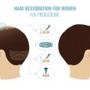 연세모벨르의원 이미지