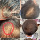 사랑의줄잇기 이미지