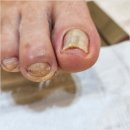 네일크루 이미지