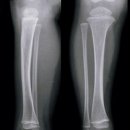 핏구공피티스튜디오&소정필라테스 이미지