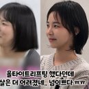 순자가 했다던 광주 올타이트 내돈내산 후기/ 리쥬란·슈링크 다 해본 솔직 비교