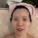 도담뷰티 | ✨죽전 피부관리 추천｜올가드림뷰티 죽전도담마을점 피지·모공관리 솔직후기