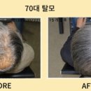 동명헤어라인 이미지