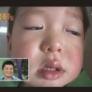 예딩