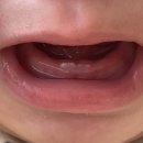 방서 참 한의원 | D+200~204 딸기도 먹고 사과도 먹는 먹짱 베이비 🍓🍎 (해원 머리박다..🙀🤯)