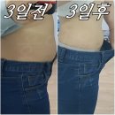 홍여우디톡스 - 부천시 오정구 | 홍여우디톡스