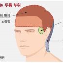 두통 심할 때 병원 가야 하는 신호 6가지 이미지