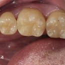 동의치과기공소 이미지