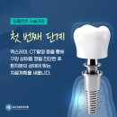 (유)대신치과기기계상사 | 언주역치과) 강남어금니임플란트 가격 UC강남치과