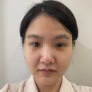 라디앙의원 | 웨딩관리 피부관리 필링 연예인관리 라디앙의원 광채필 추천! 리얼후기