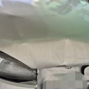 우리 아방이 1.8~2.0 전면 추돌사고로 얼굴성형복원기 이미지