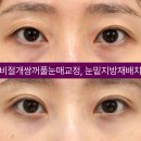 아이케이성형외과의원 네이버블로그