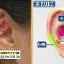 나는 몸신이다. 귀 반사요법. 리프팅에 좋은 귀 지압방법. 이미지