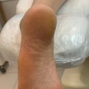 레푸스 정자점 | 분당발각질관리 분당굳은살관리 분당굳은살제거 박은서푸스플레게 레푸스 정자점 후기