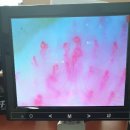 개봉의료기 이미지