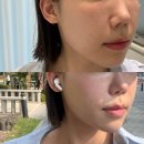뉴페이스 - 남구 | 마곡피부관리 추천 뉴벨 에스테틱 뉴 페이스 윤곽 관리 후기