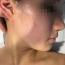 2024 기초농구(토) | [사당역] 더 물오름/ 윤곽관리 후기/ 데콜테 관리/ 사당역 피부관리/ 사당피부관리