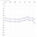 유니트론 보청기 이미지