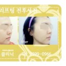 이뻐지자