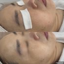 라미메디 | [노원 피부관리] 가을철 피부각질관리 화장잘먹는 관리 / 노원 림프순환 마사지 하계동 리메디뷰티