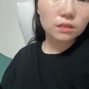 마움 | 모공축소팩으로 피부결 관리 시작, 눈가 지방 입가 주름 개선에 도움됐던 마움 리핏 마스크 후기