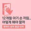 동부의원 | 12개월 아기 손 끼임 사고 후기 | 찢어진 상처 응급 대처 + 대치동부센트러빌 유외과 방문 경험