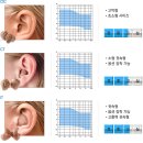 독일 보청기 양산센터 이미지