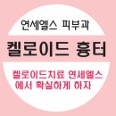 연세엘스의원 이미지