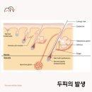 원일건재 | 모발이식 수술 받아보니 (모발이식 배경지식, 비용, 직장 문제, 주변 반응)