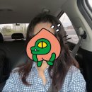 이지에프올로지의원 | 모앤라인성형외과 후기｜이마 축소 후 흉터 재교정