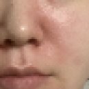 충주 최피부과 의원, 수 메디컬의원 (수피부과) 중 내 선택은 ? / 면역력 떨어진 피부 나아지는 팁까지