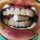 부마치과 이미지