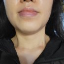 홍대피부관리 홍대뷰티클럽 후기