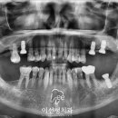 이선생 치과의원 네이버블로그