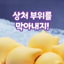 태선 티스토리
